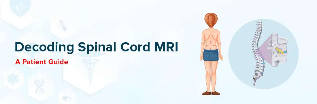 Decoding Spinal Cord MRI: A Patient Guide